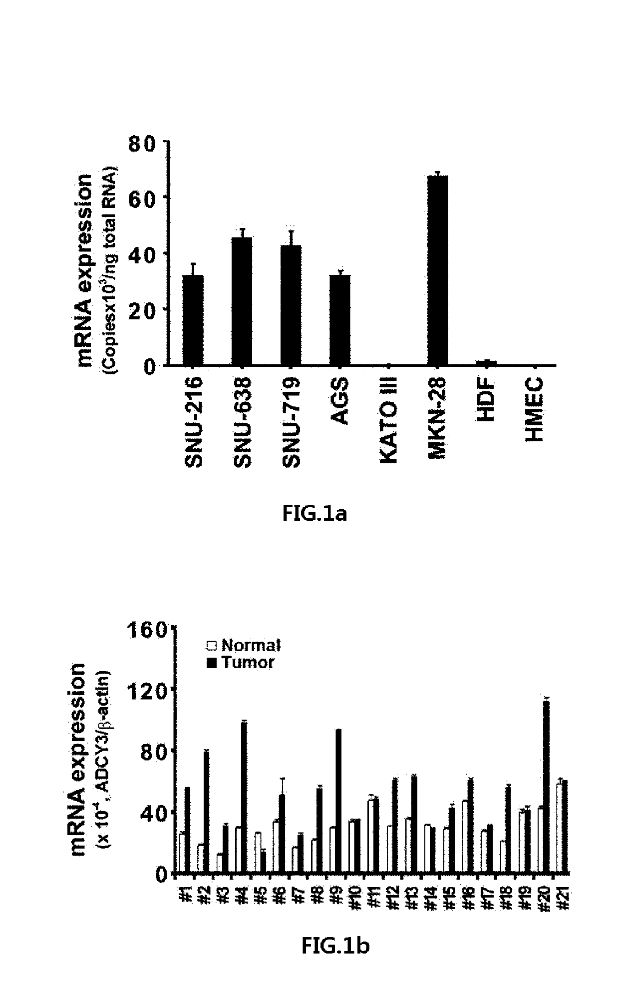 Use of ADCY3 for diagnosis and treatment of gastric cancer