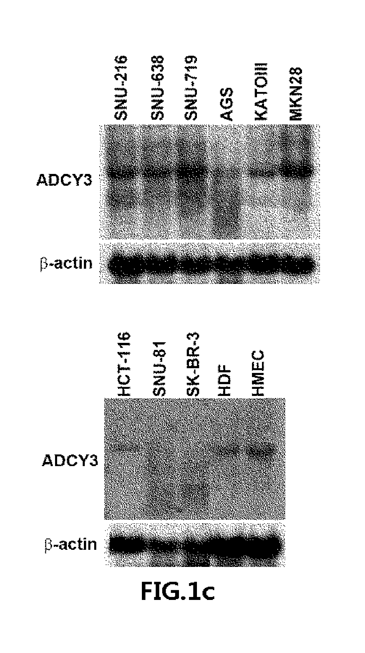 Use of ADCY3 for diagnosis and treatment of gastric cancer