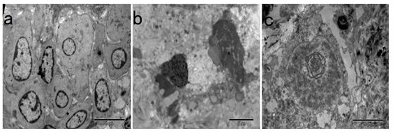 Serum-free culture solution for in-vitro culture of sheep ovarian cortex tissue