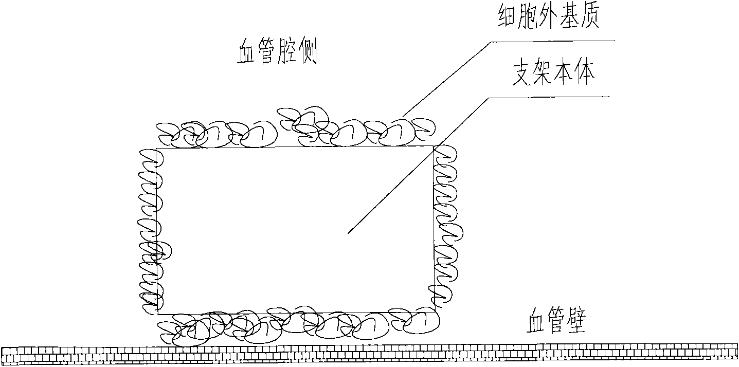 A medical equipment carrying extracellular matrix and its production method