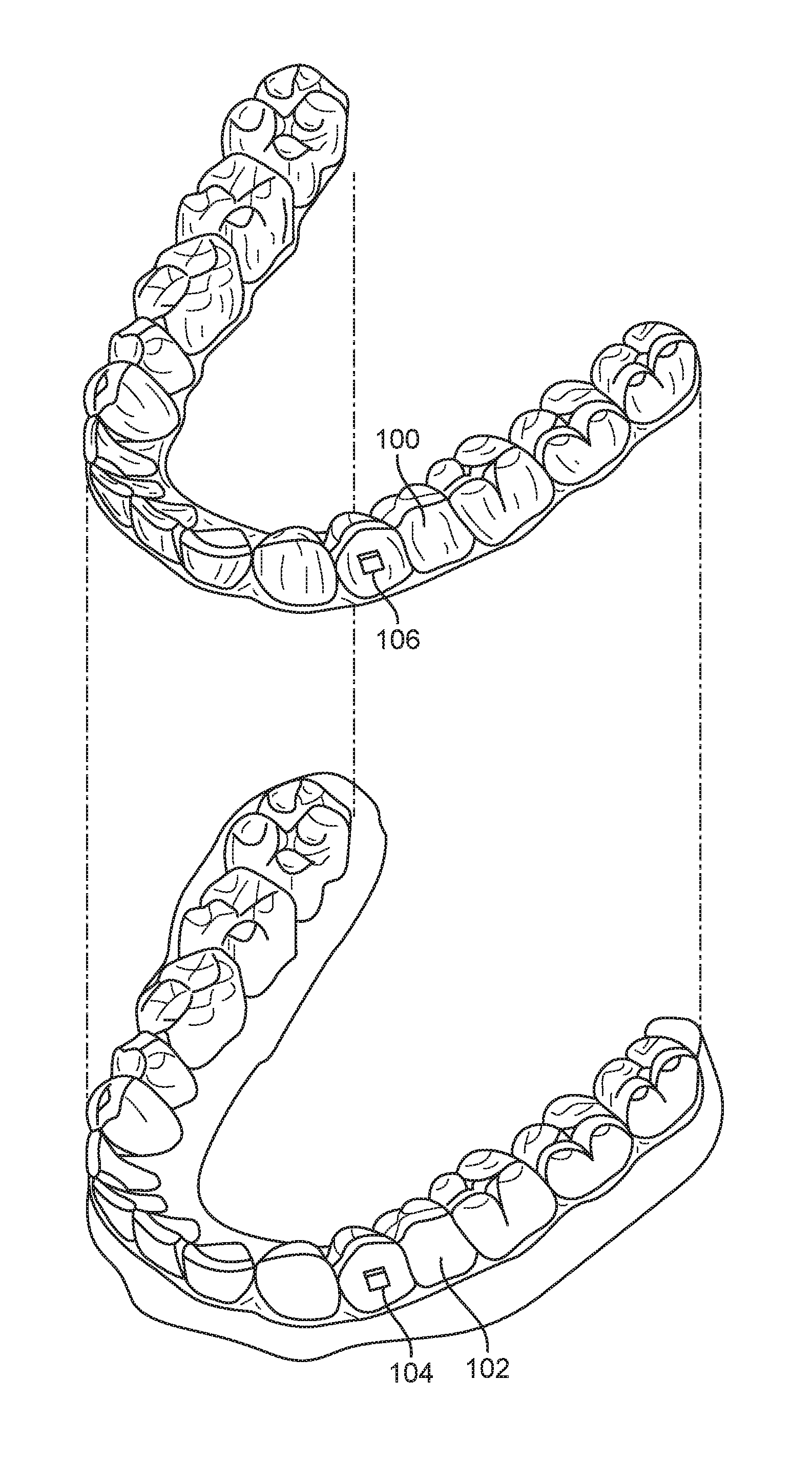 Direct fabrication of aligners with interproximal force coupling