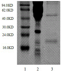 Indirect ELISA (enzyme-linked immuno-sorbent assay) kit for detecting nephropathogenic avian infectious bronchitis virus and antibody thereof