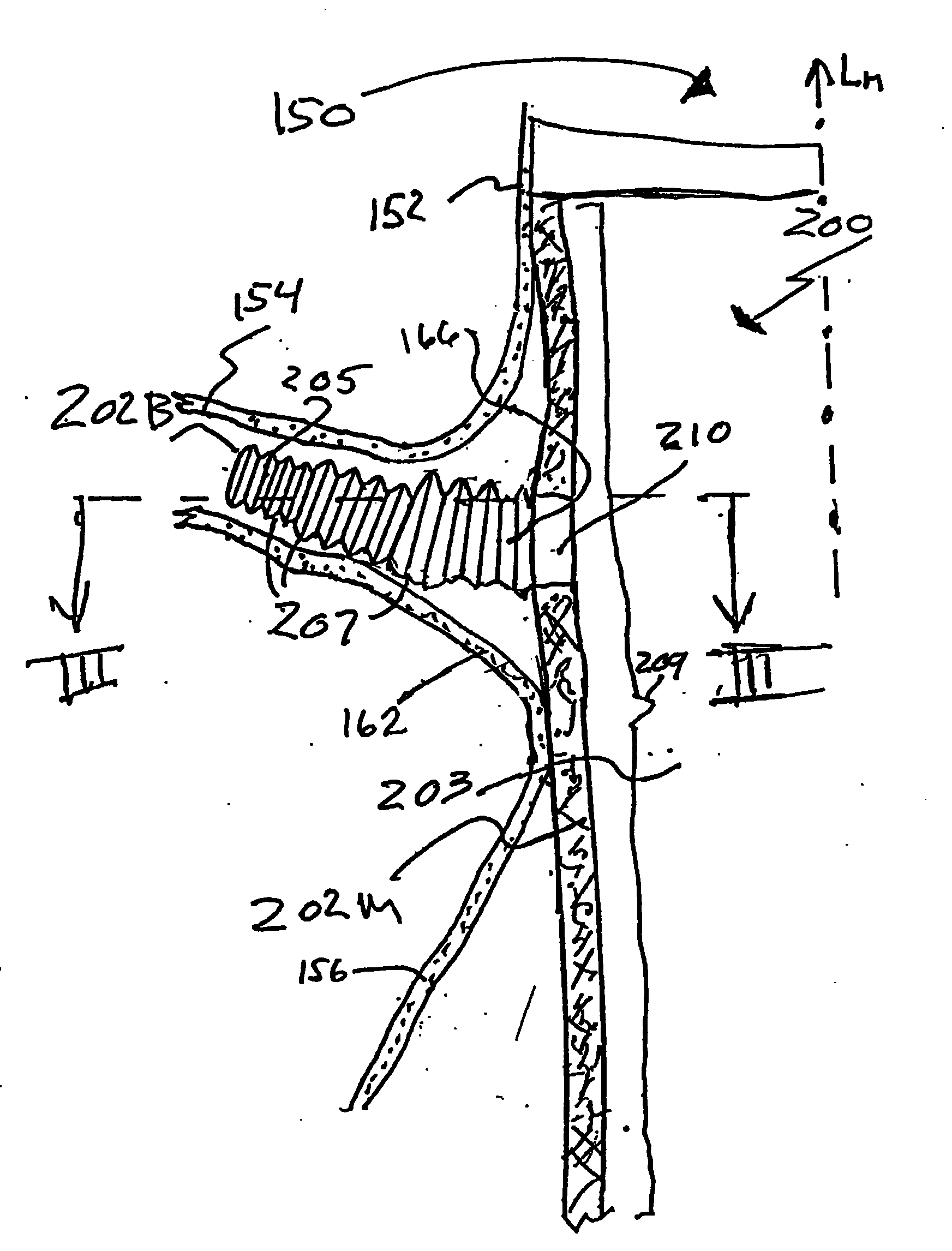 Stent Graft Having a Flexible, Articulable, and Axially Compressible Branch Graft