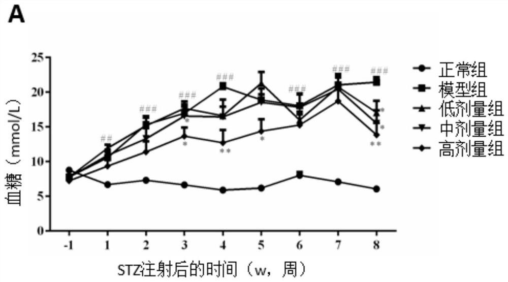 A kind of selenium-enriched Bifidobacterium longum and its preparation method and application