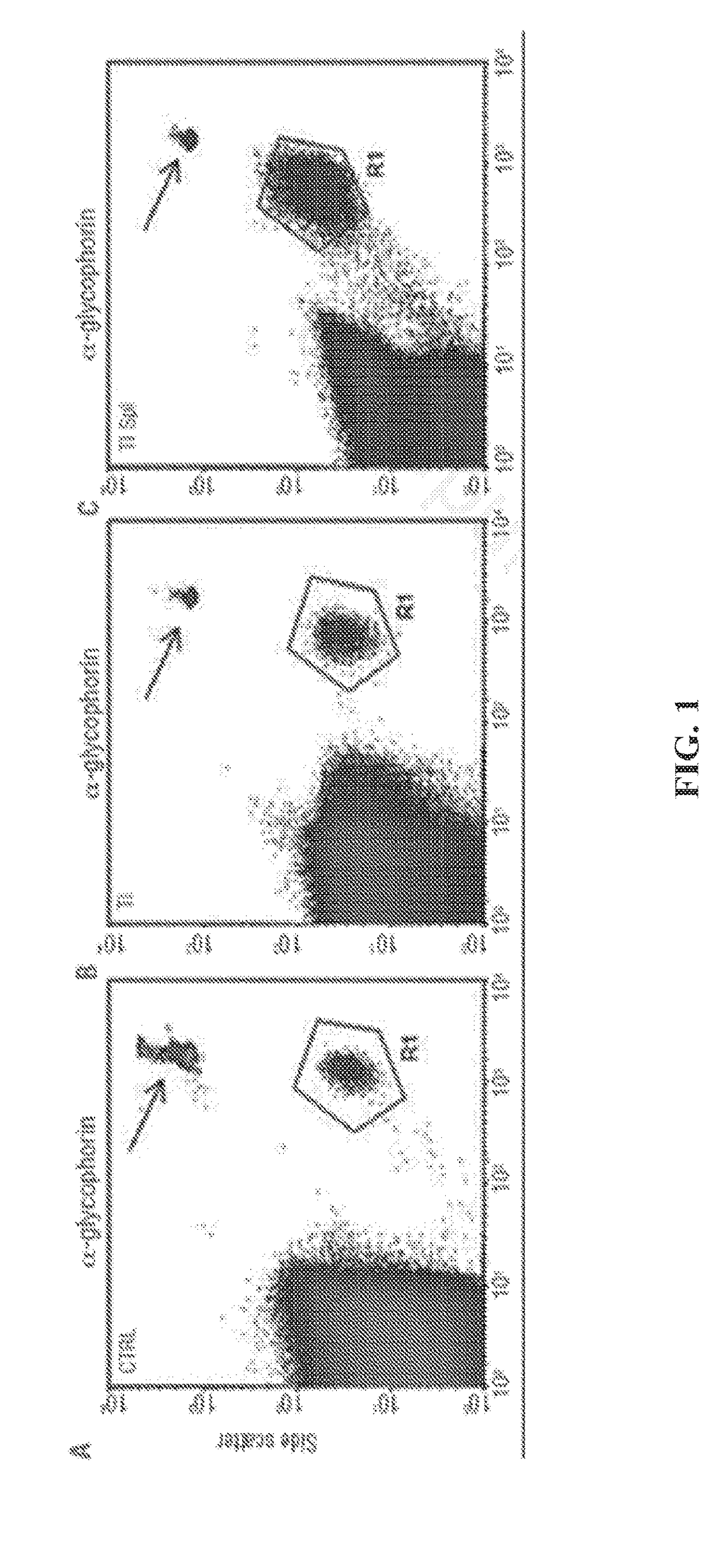 Methods for treating hemolytic diseases and sickle cell disease