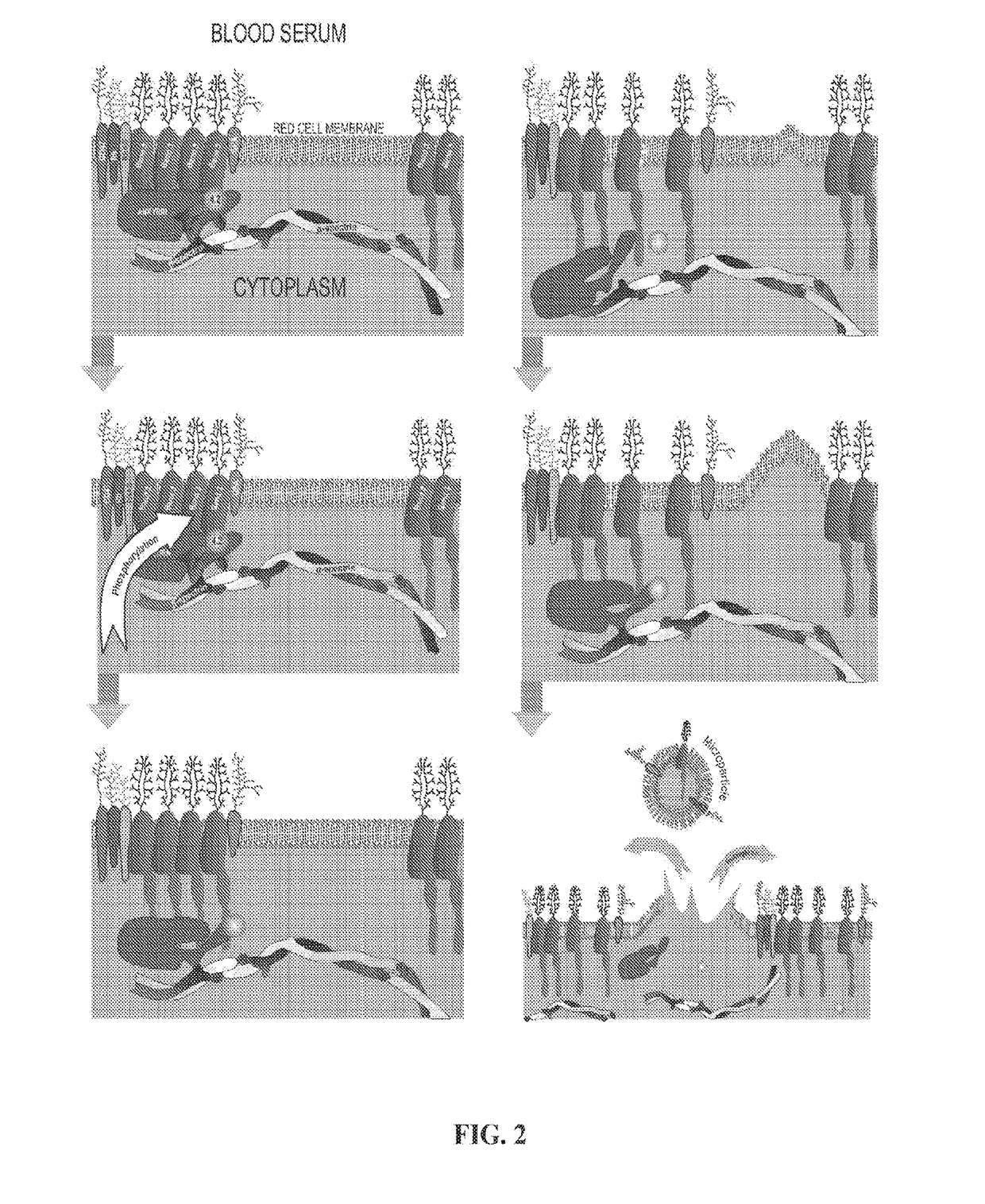 Methods for treating hemolytic diseases and sickle cell disease