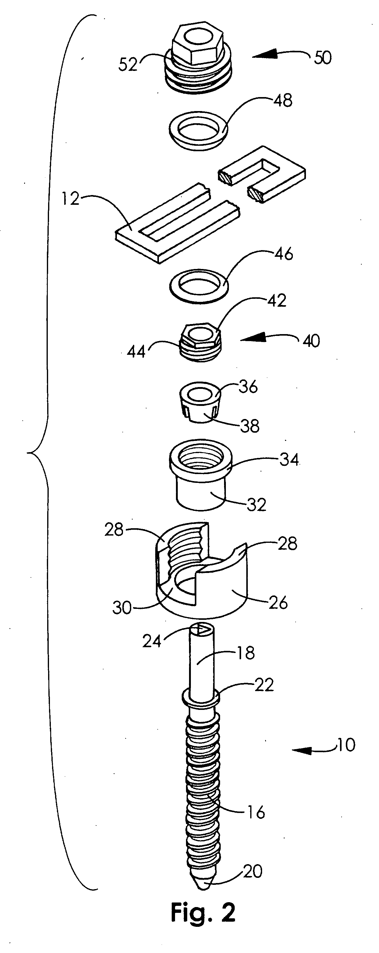 Spinal fixation system