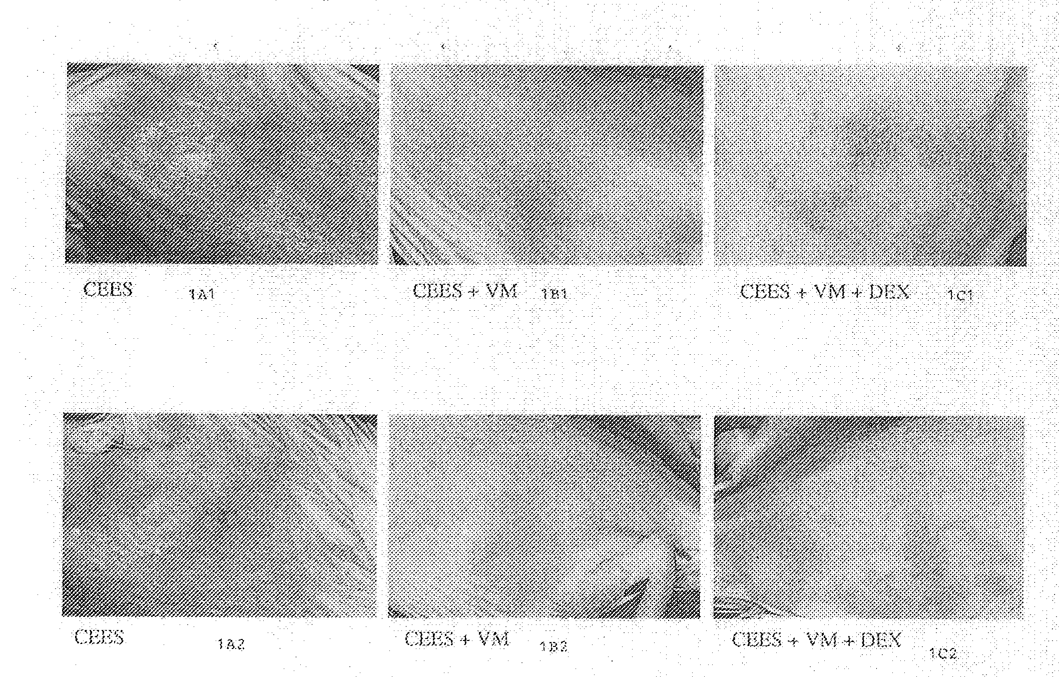 Composition for treating sulfur mustard toxicity and methods of using same