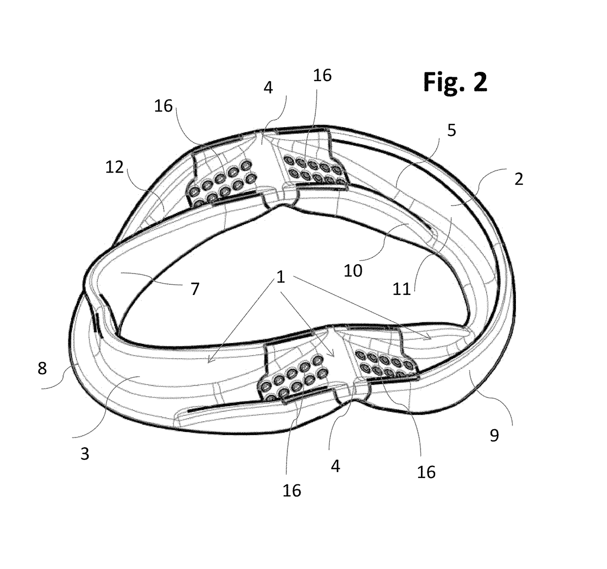 Incremental and/or successive adjustable mandibular advancement device for preventing and treatment of snoring and obstructive sleep apnea