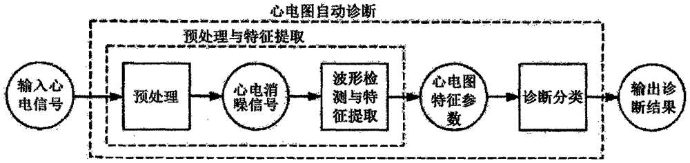 Clinical examination method of electrocardio intelligent analyzing system