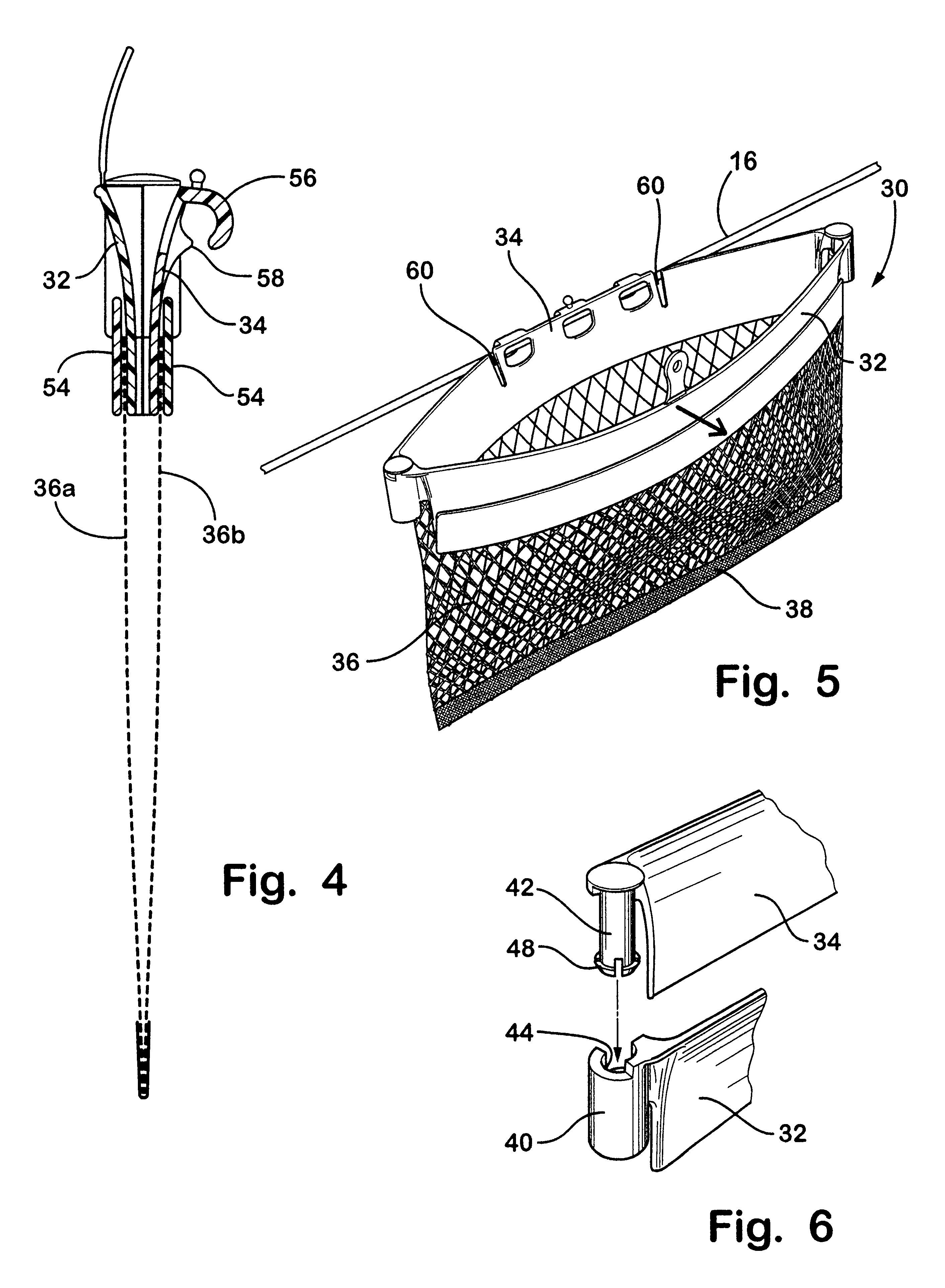 Small items bag for use in dishwasher