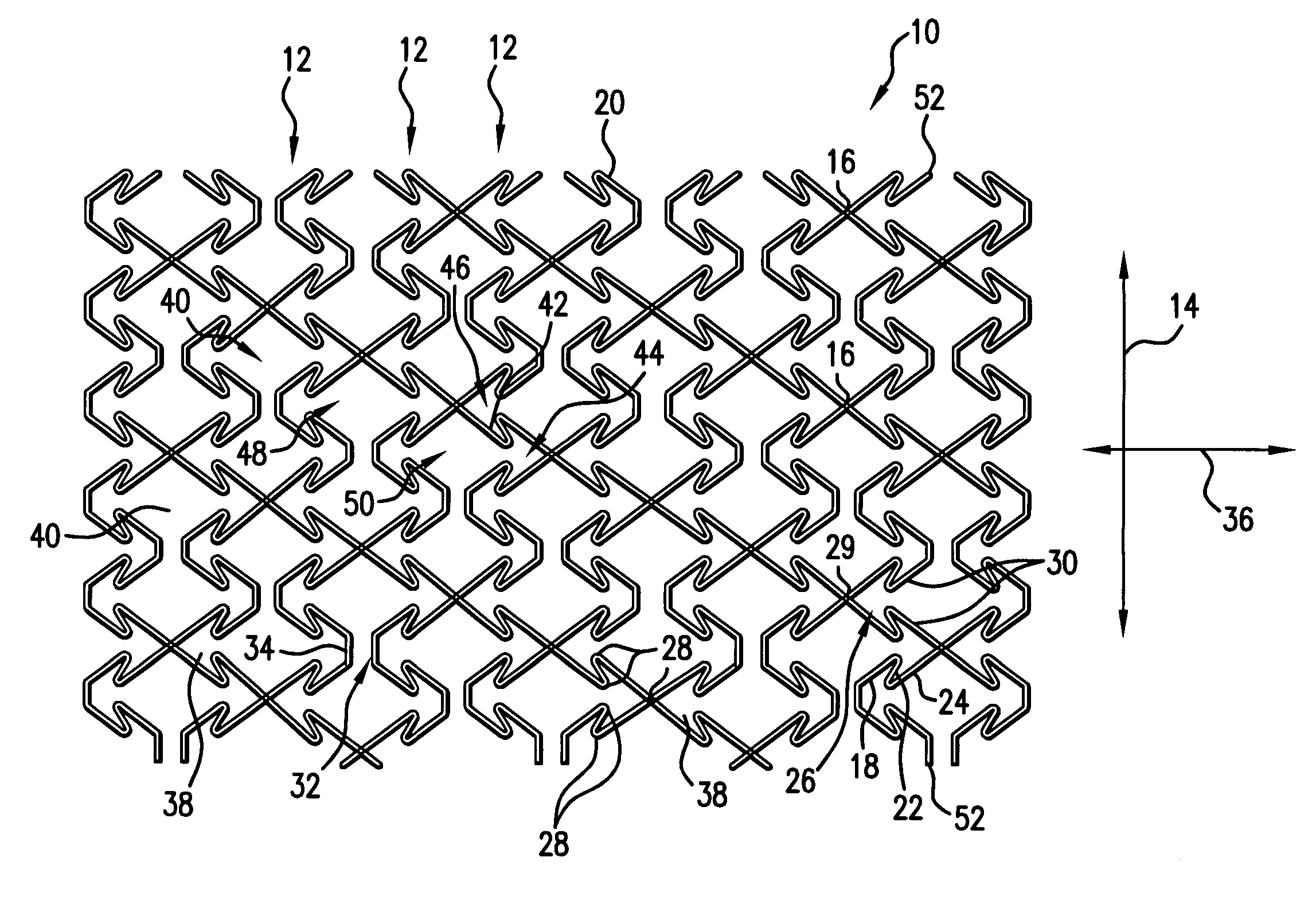 Endoprosthesis for controlled contraction and expansion