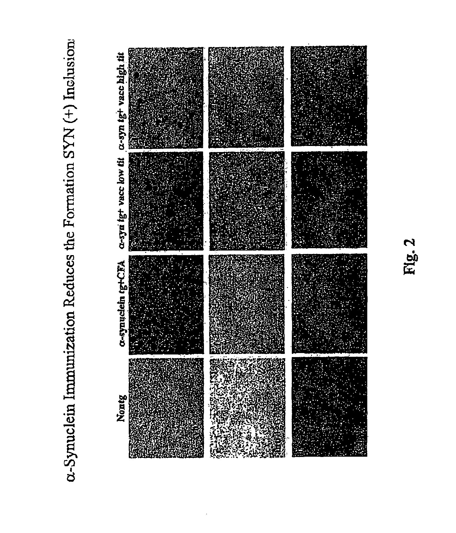 Prevention and Treatment of Synucleinopathic and Amyloidogenic Disease