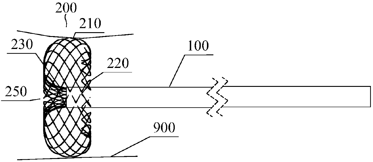 Endovascular anchoring catheter