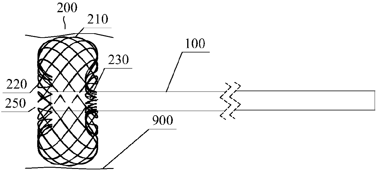 Endovascular anchoring catheter