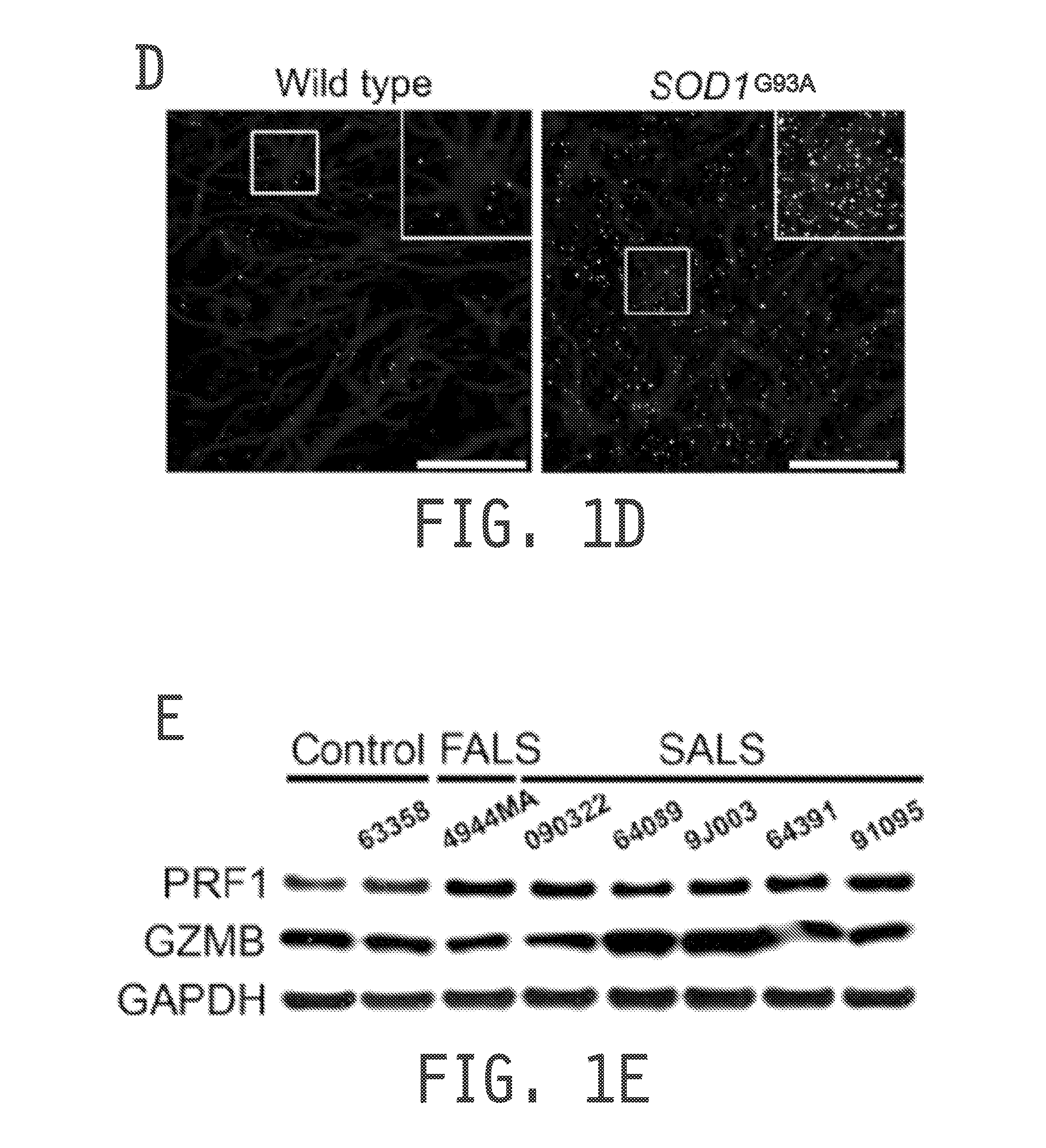 Compositions and methods for treating amyotrophic lateral sclerosis