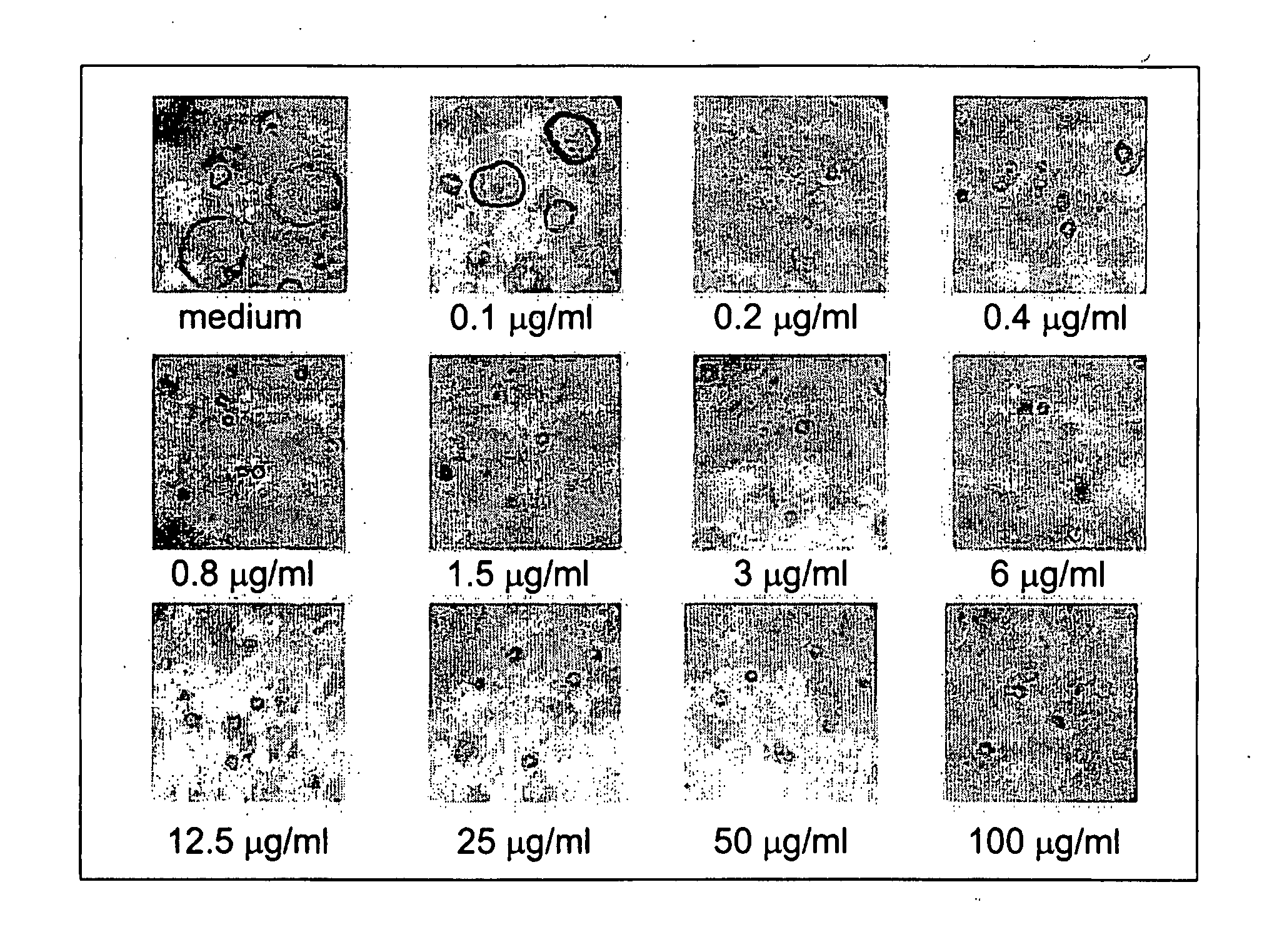 Methods and compositions for the treatment of polycystic diseases