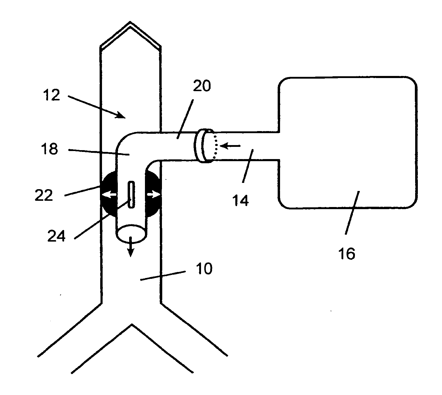 Tracheostomy tube