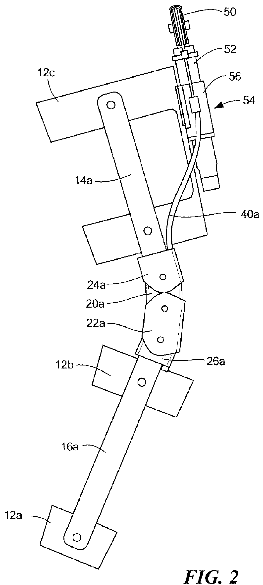 Brace system