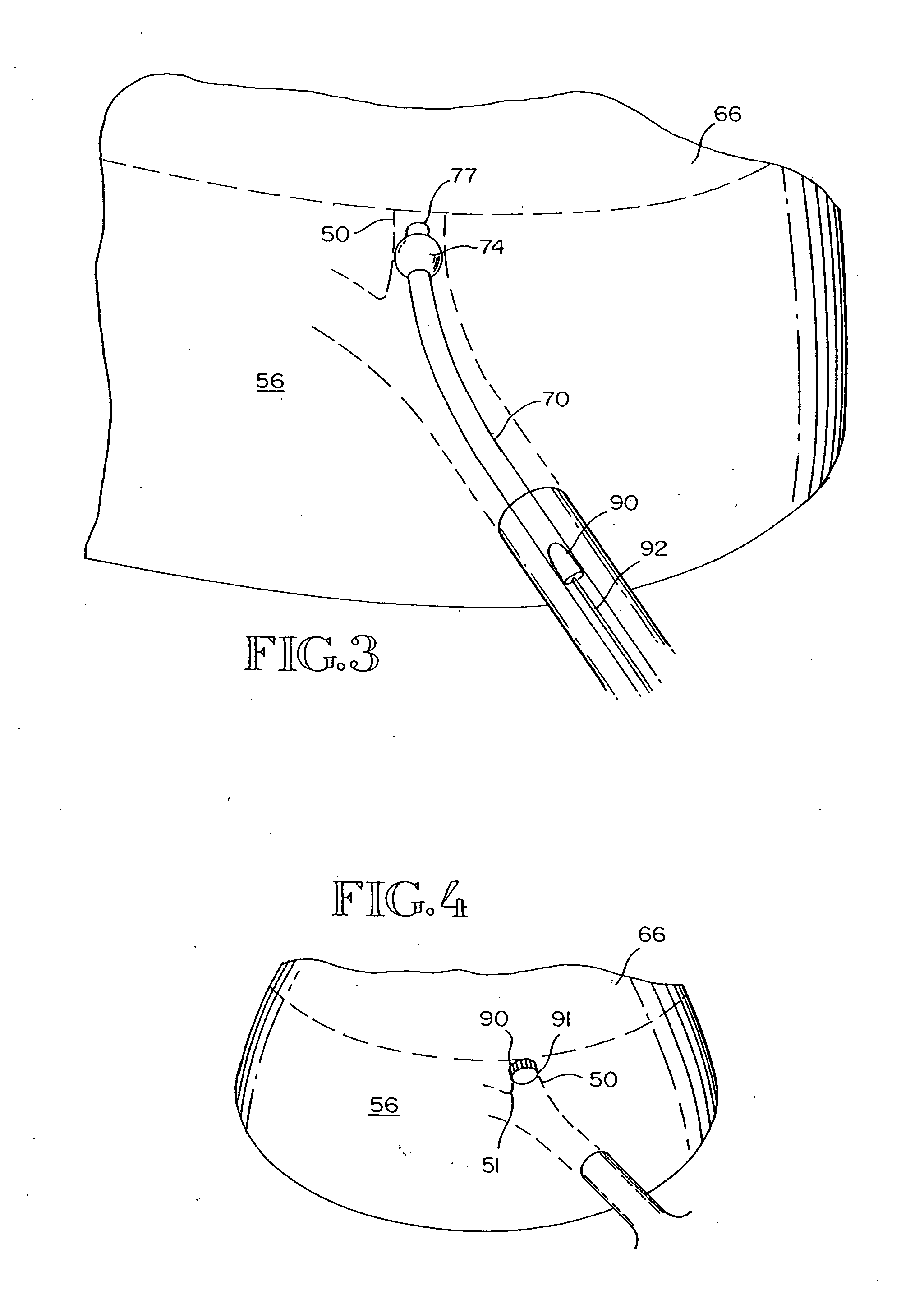 Intra-bronchial obstructing device that controls biological interaction with the patient