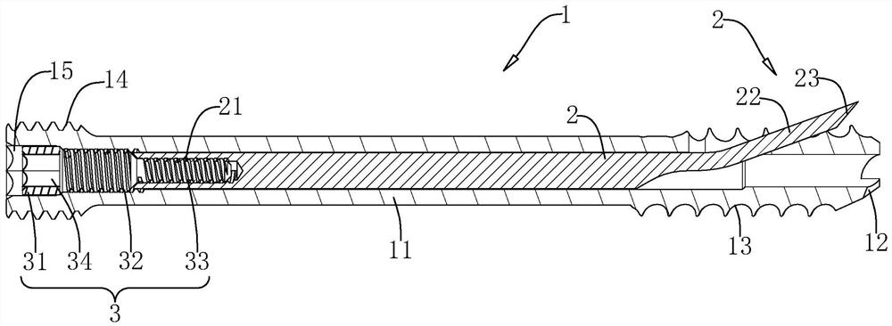 An anti-rotation and anti-retreat double-threaded hollow nail