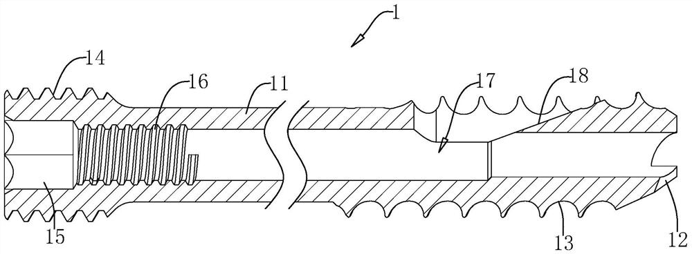 An anti-rotation and anti-retreat double-threaded hollow nail