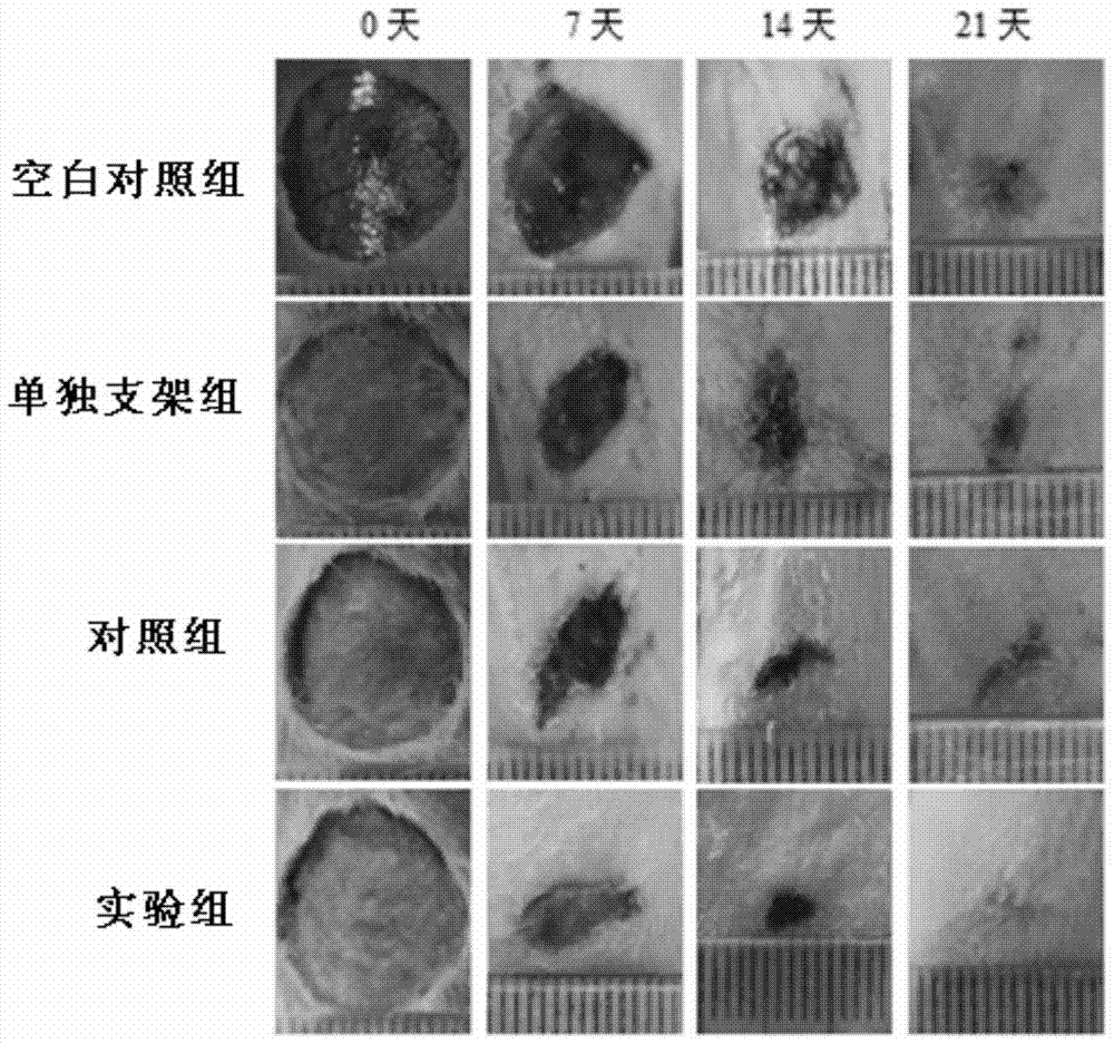 Collagen-chitosan tissue engineering scaffold compounded with tβ4 and its preparation method and application