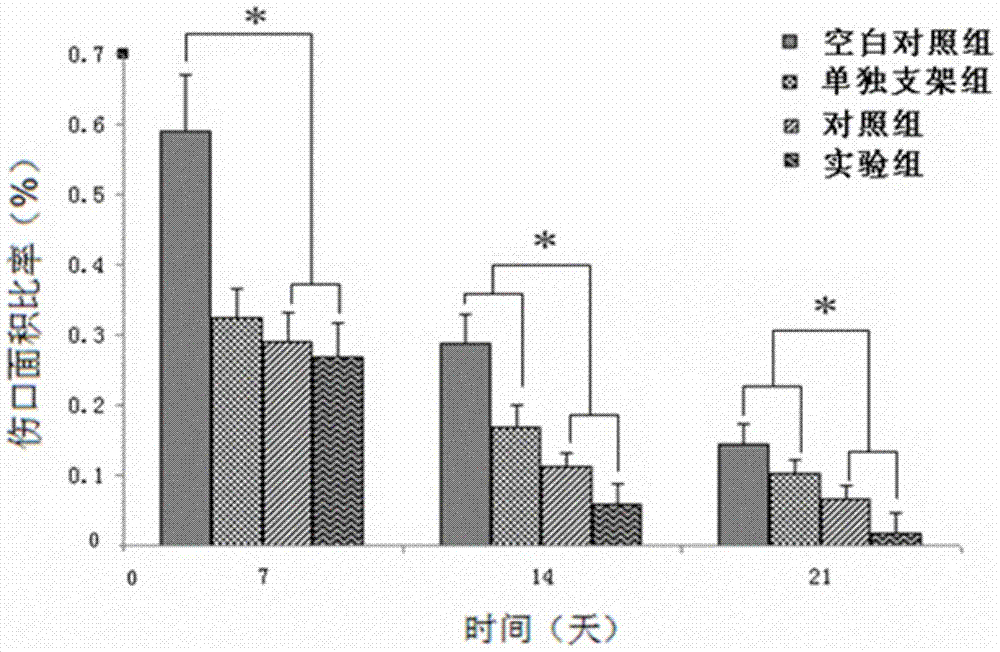 Collagen-chitosan tissue engineering scaffold compounded with tβ4 and its preparation method and application