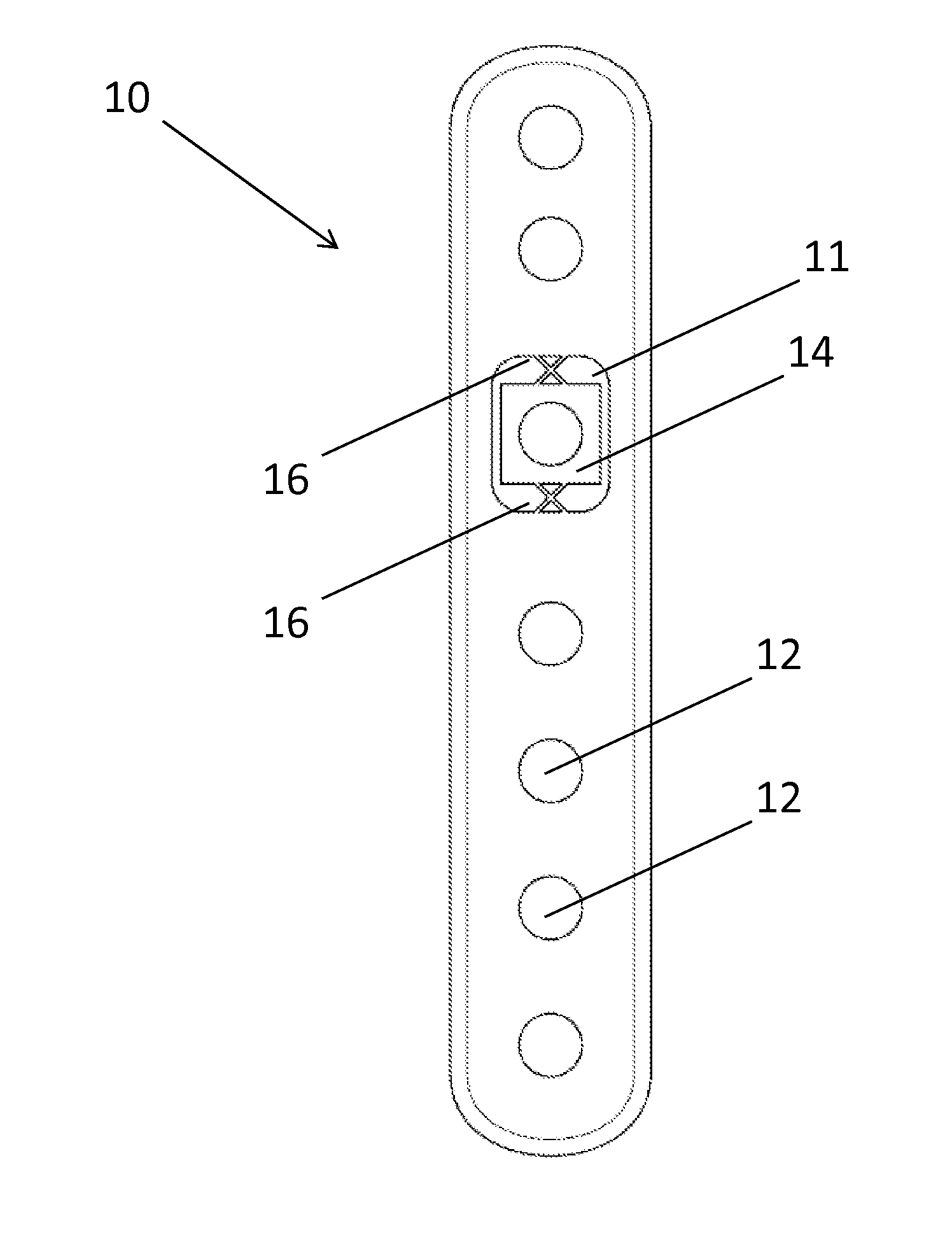 Flexible locked plate fixation