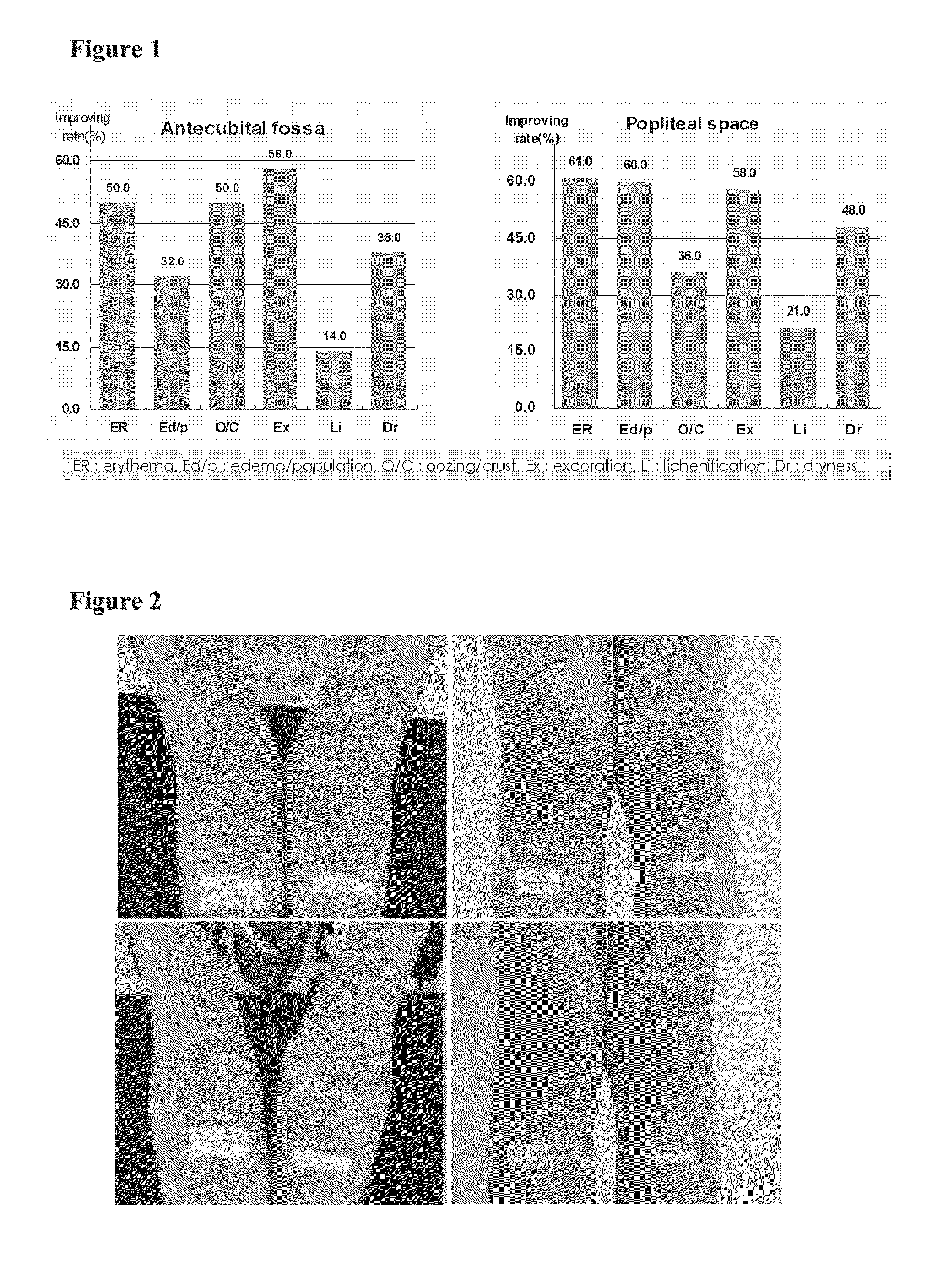 Composition for treating atopic dermatitis comprising extracts of bamboo and scutellaria