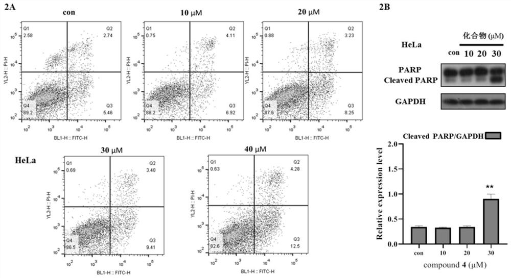 Preparation of isopentenyl flavone and application of isopentenyl flavone as medicine for treating cervical cancer