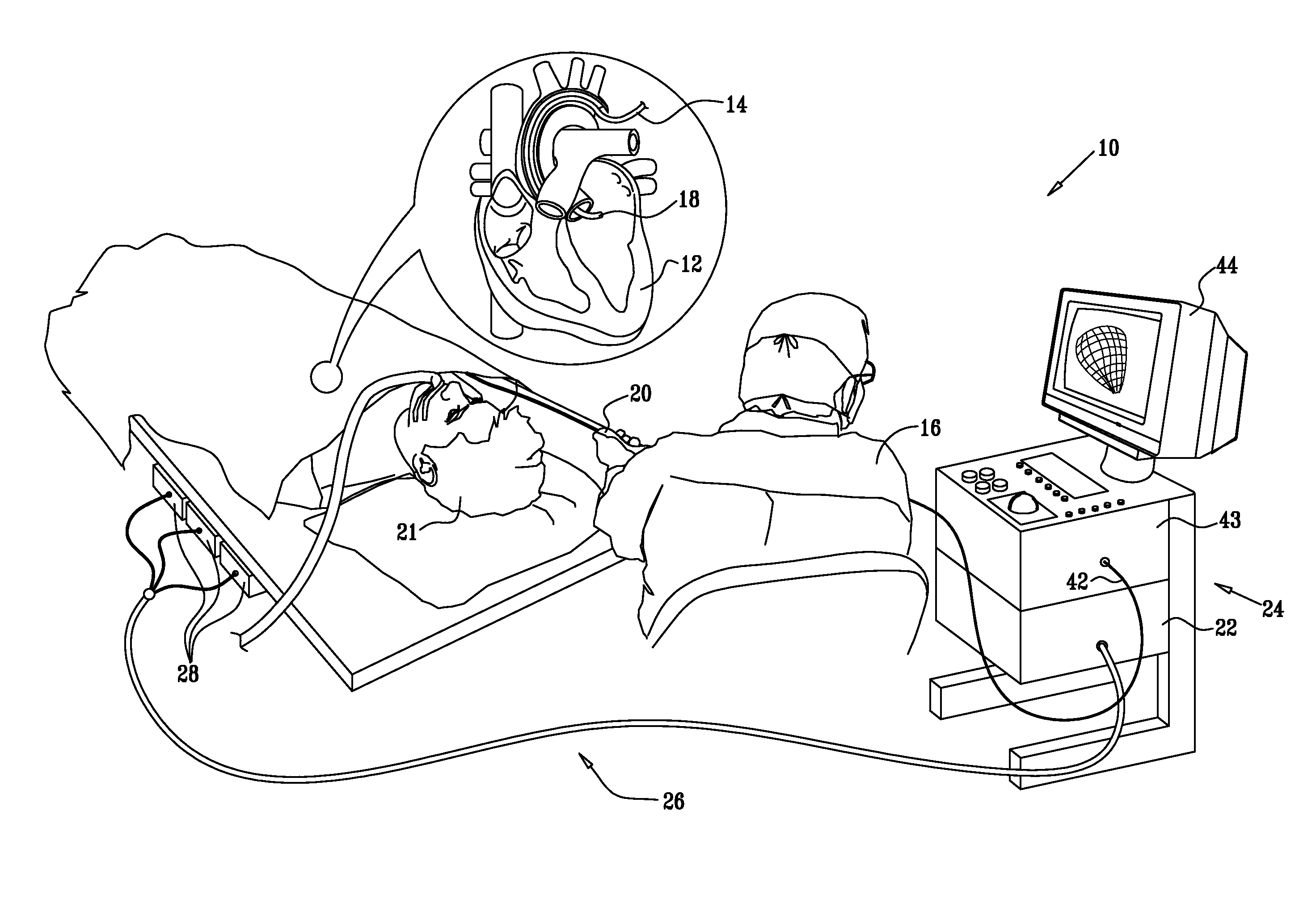 Mapping of complex fractionated atrial electrogram