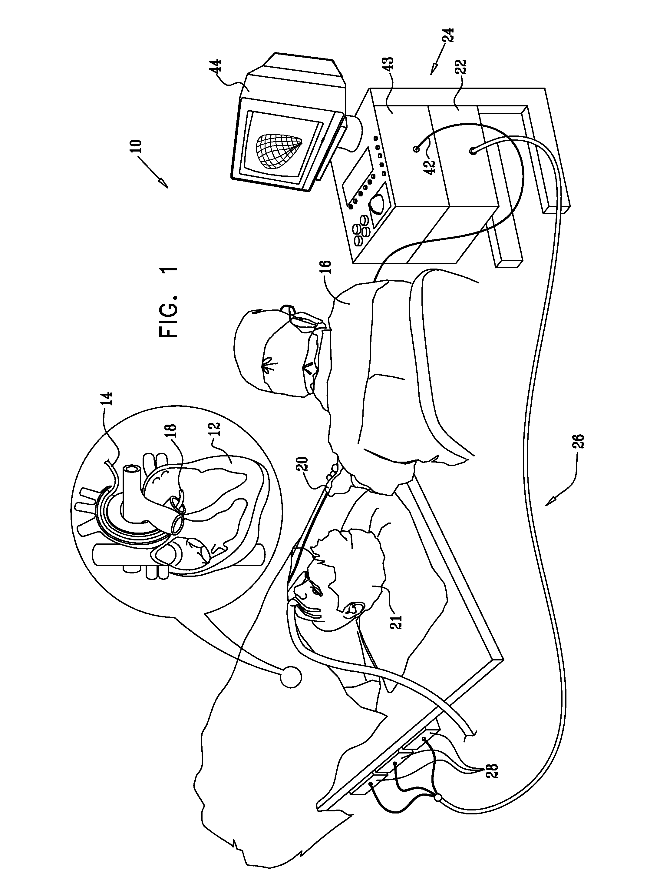 Mapping of complex fractionated atrial electrogram