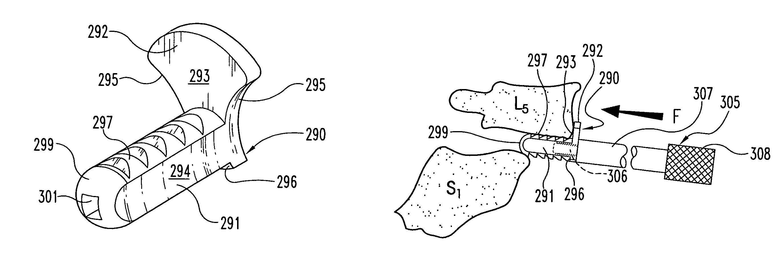 Methods and instruments for interbody fusion