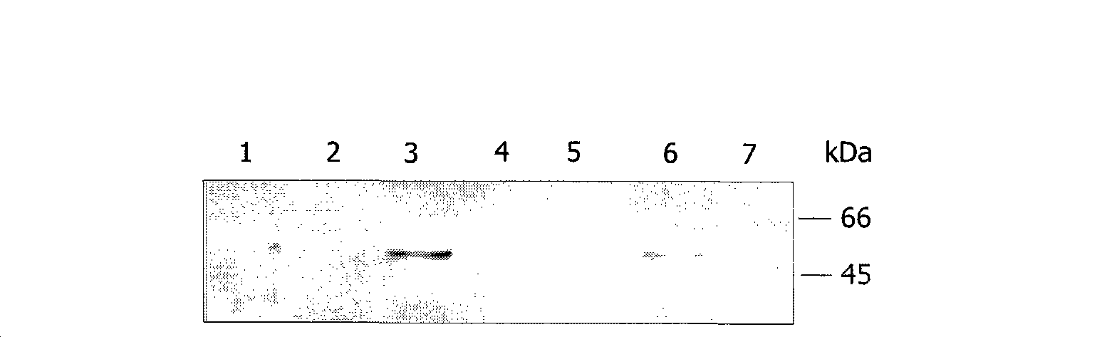 Methods and compositions for treating neurodegenerative disorders and alzheimer's disease and improving normal memory