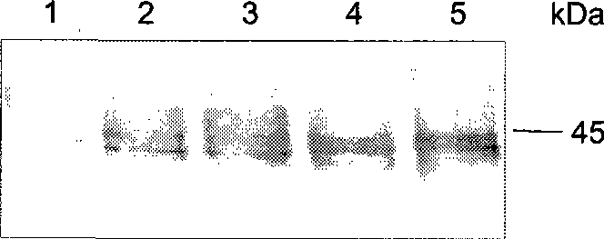 Methods and compositions for treating neurodegenerative disorders and alzheimer's disease and improving normal memory