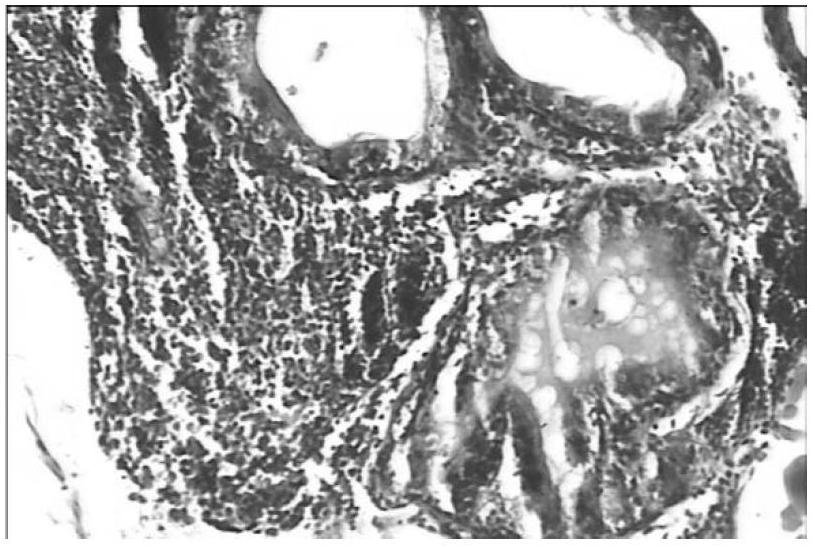 Medicine composition for treating prostatitis and preparation method and application thereof