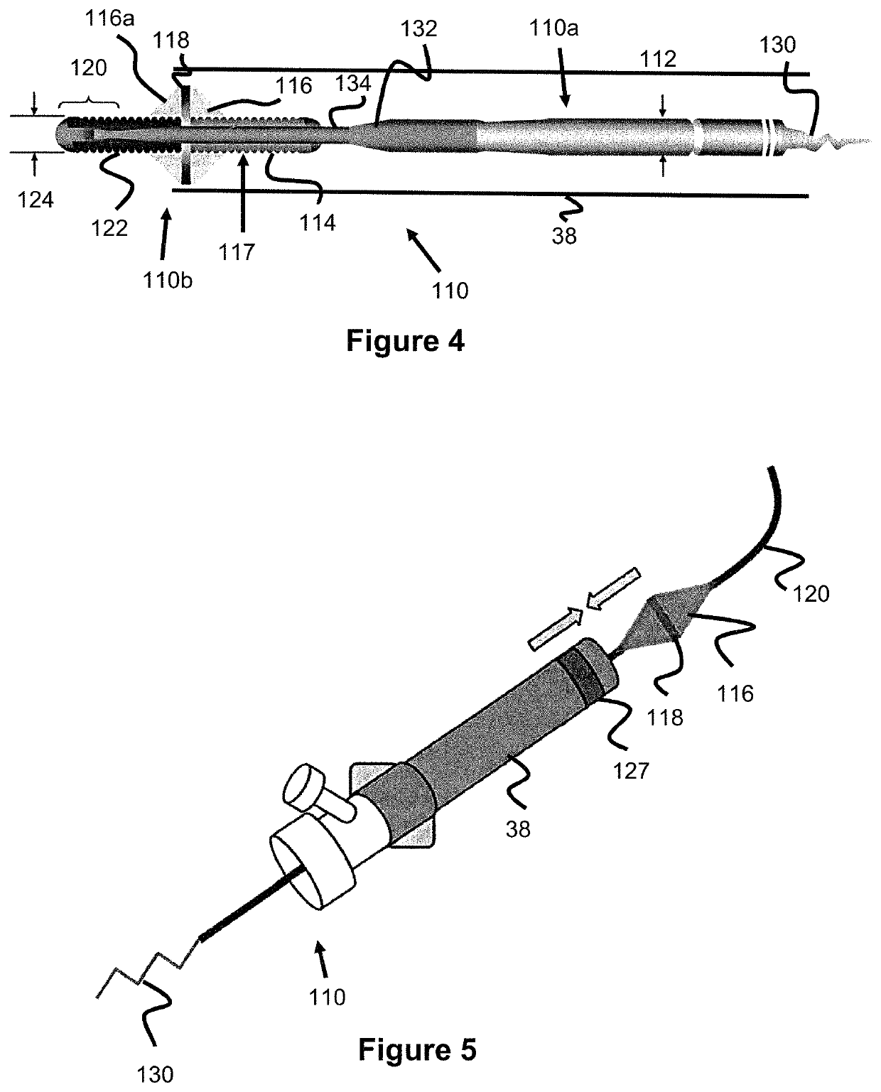 Intravascular treatment site access