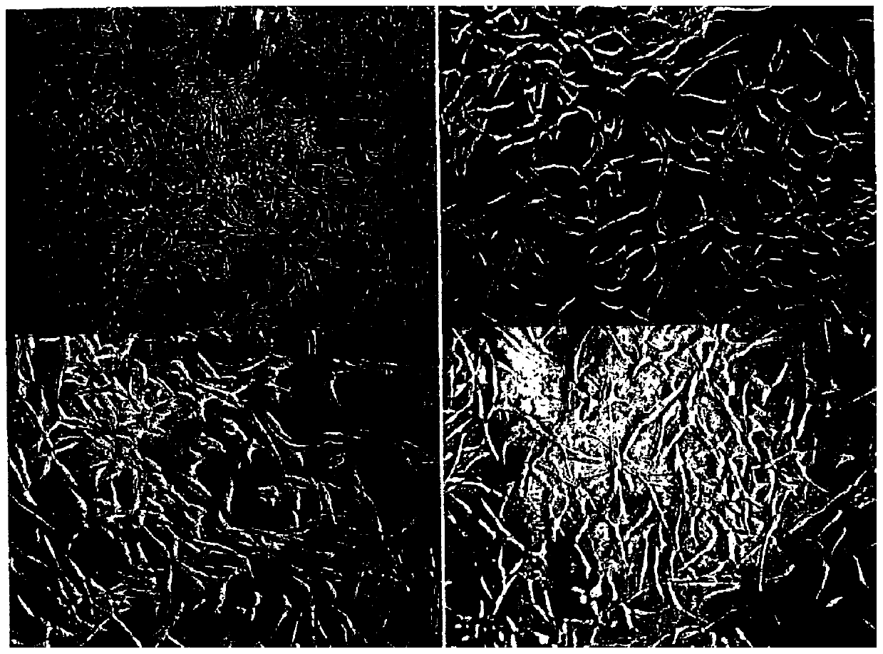 A kind of polypeptide hydrogel, its preparation method and application