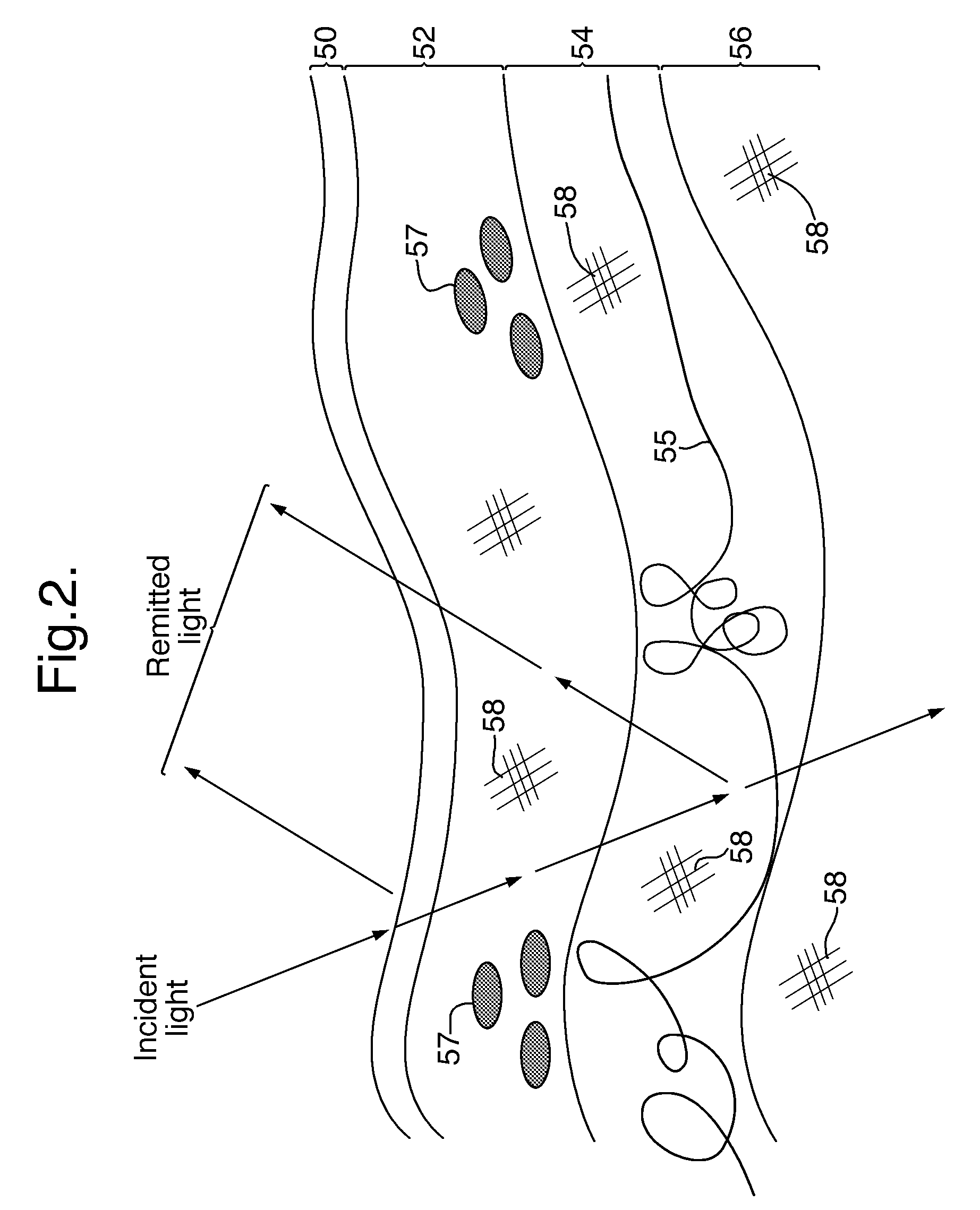 Method and apparatus for obtaining a measurement of sun damage