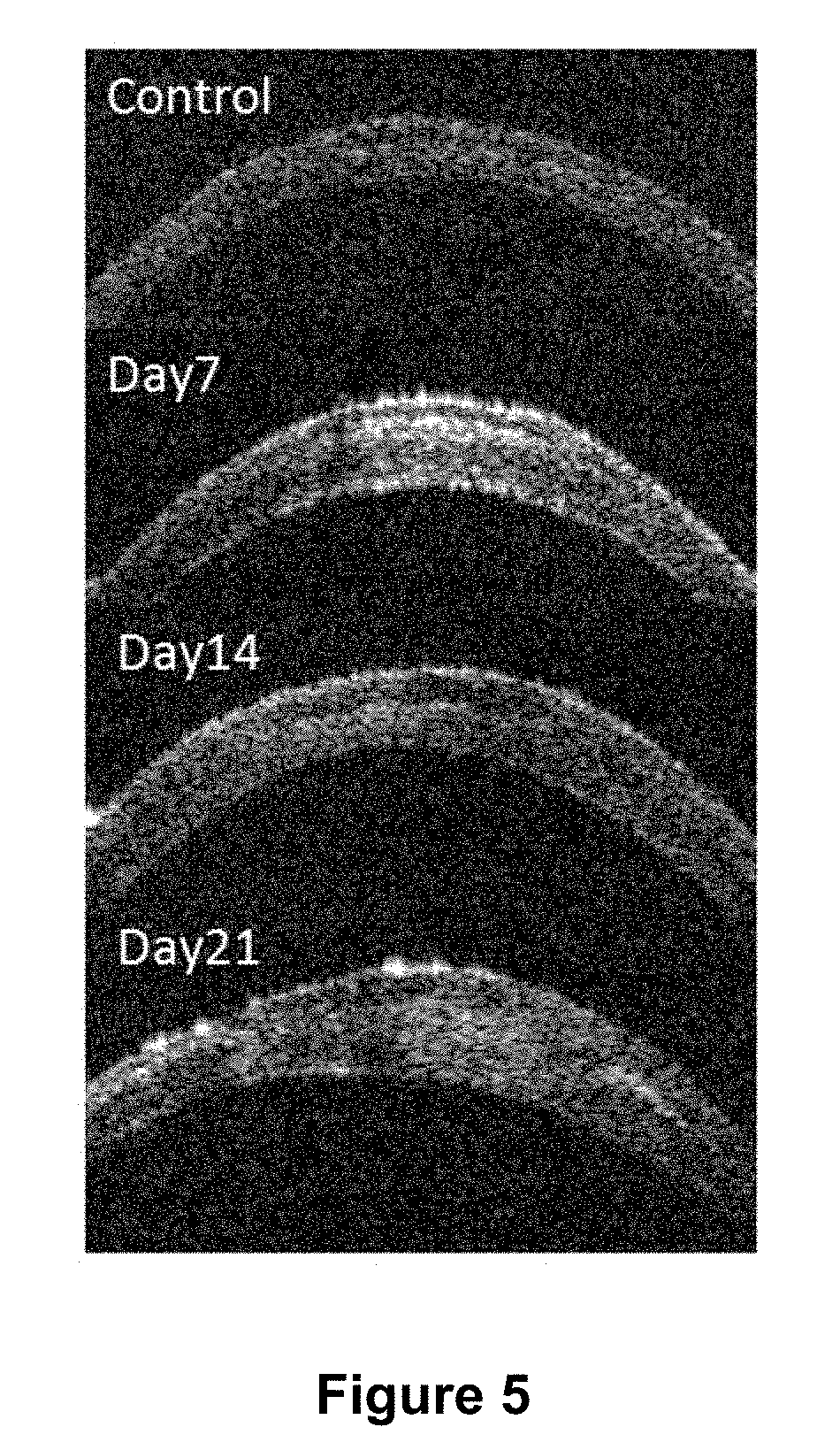 Methods of reducing corneal endothelial cell loss