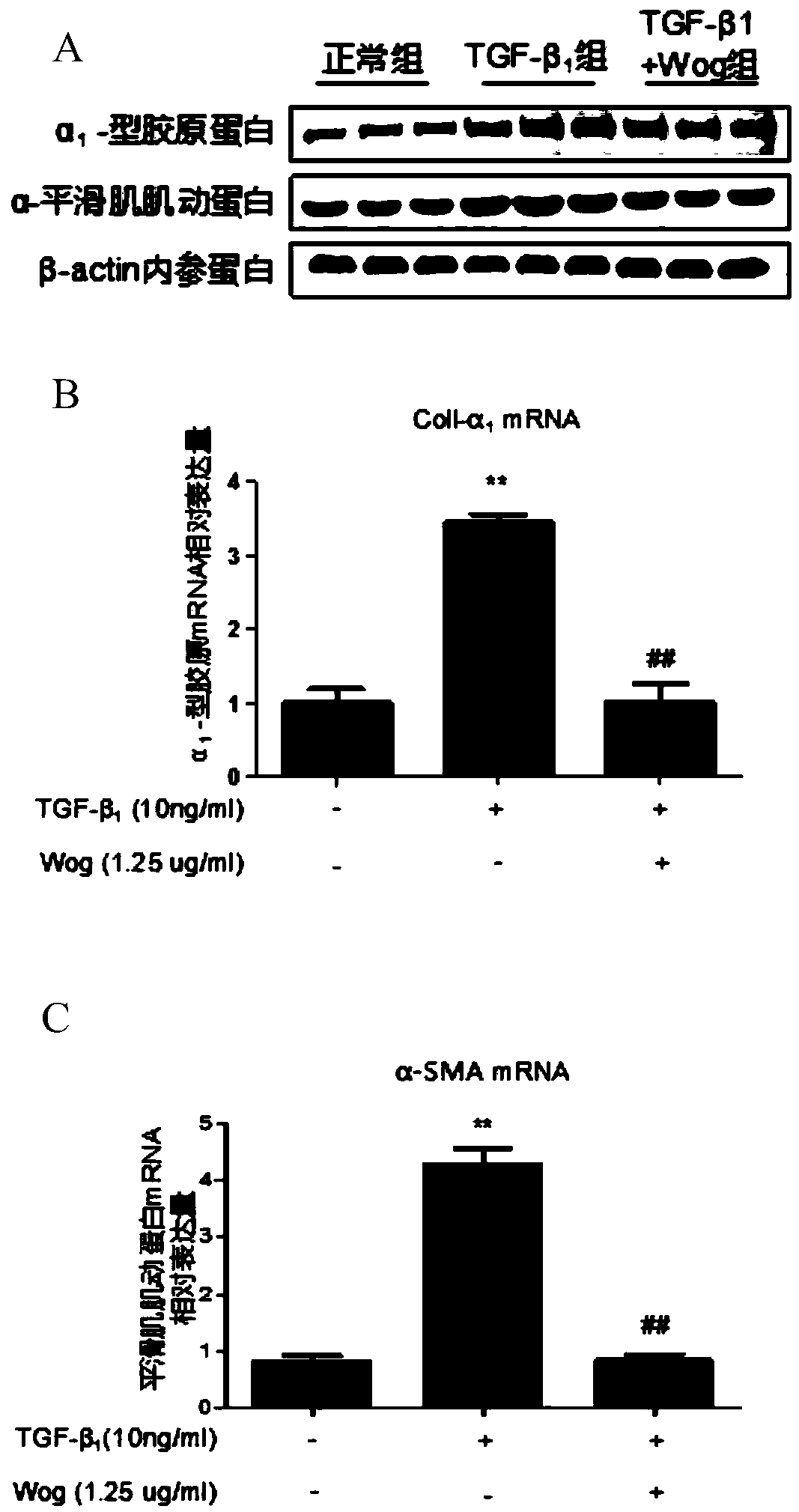 Application of wogonin in preparation of drug for treating hepatic fibrosis