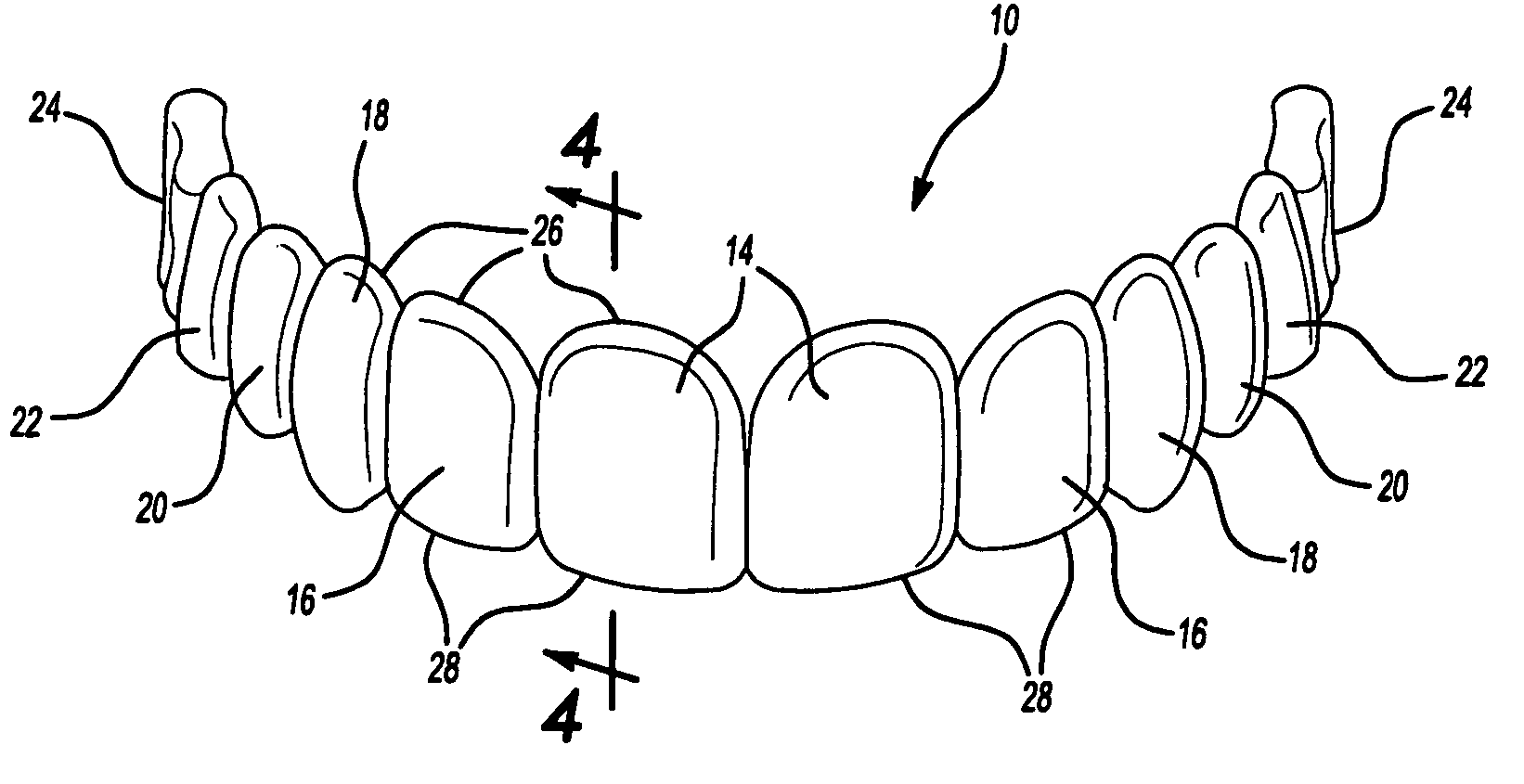 Dental template and method of visually demonstrating an overlay for a dental patient and setting the horizontal plane with an overlay