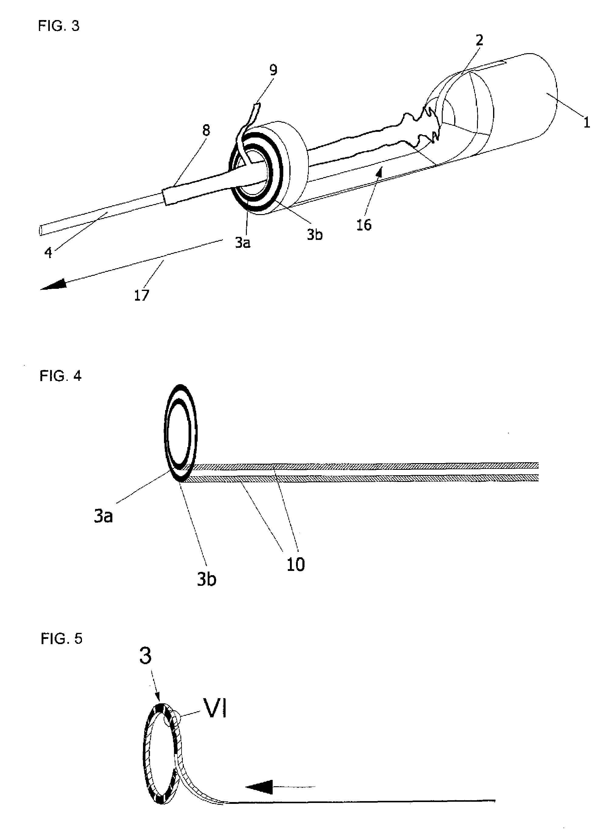 Stripping device for removal of varicose veins