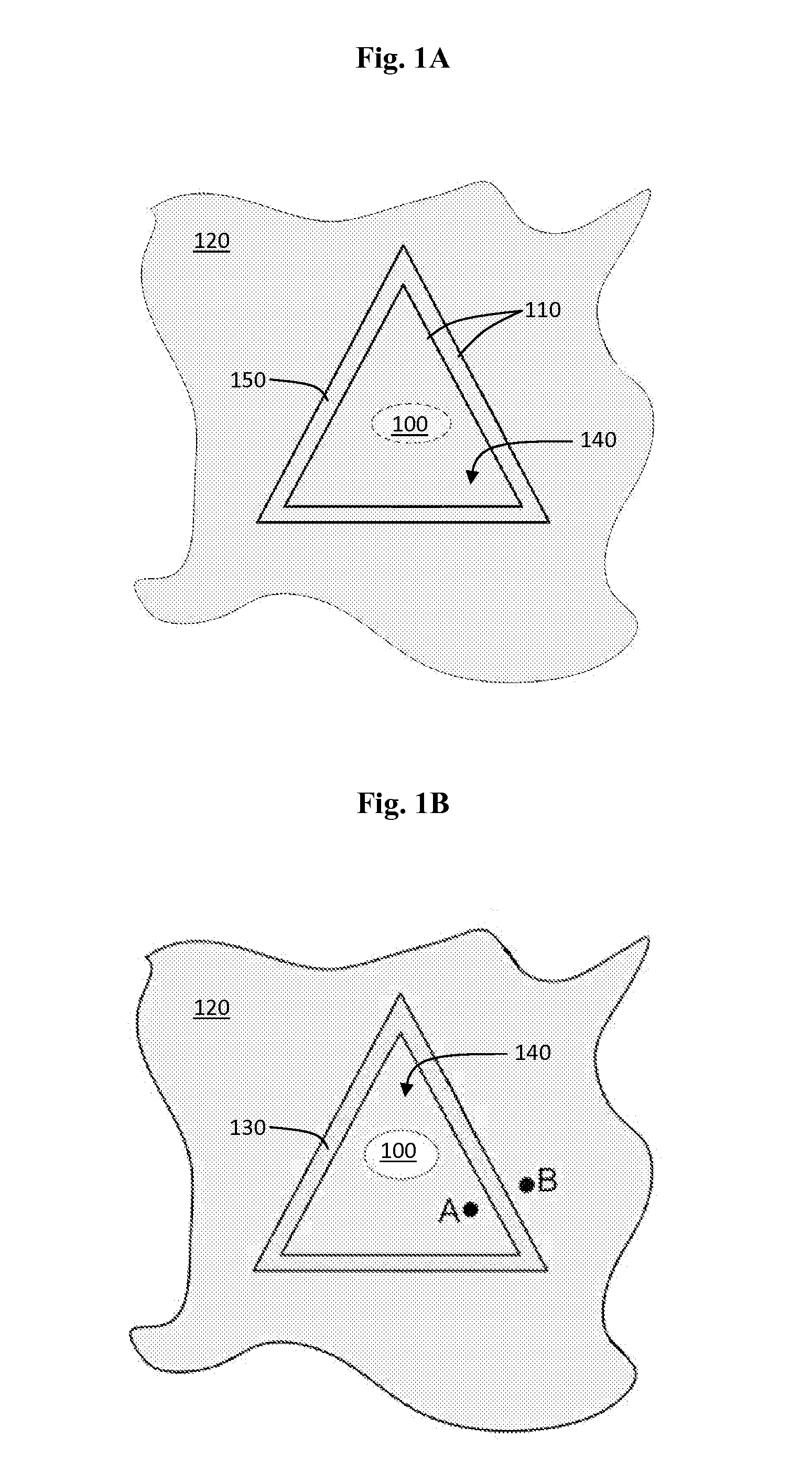 Laser Device and Method for Decreasing the Size and/or Changing the Shape of Pelvic Tissues