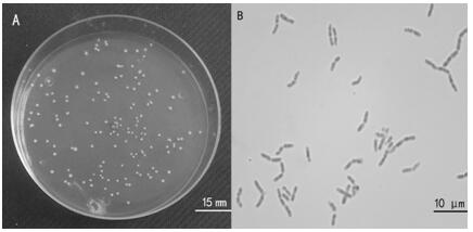 Application of lactobacillus salivarius fermentation liquor as feed mildew preventive