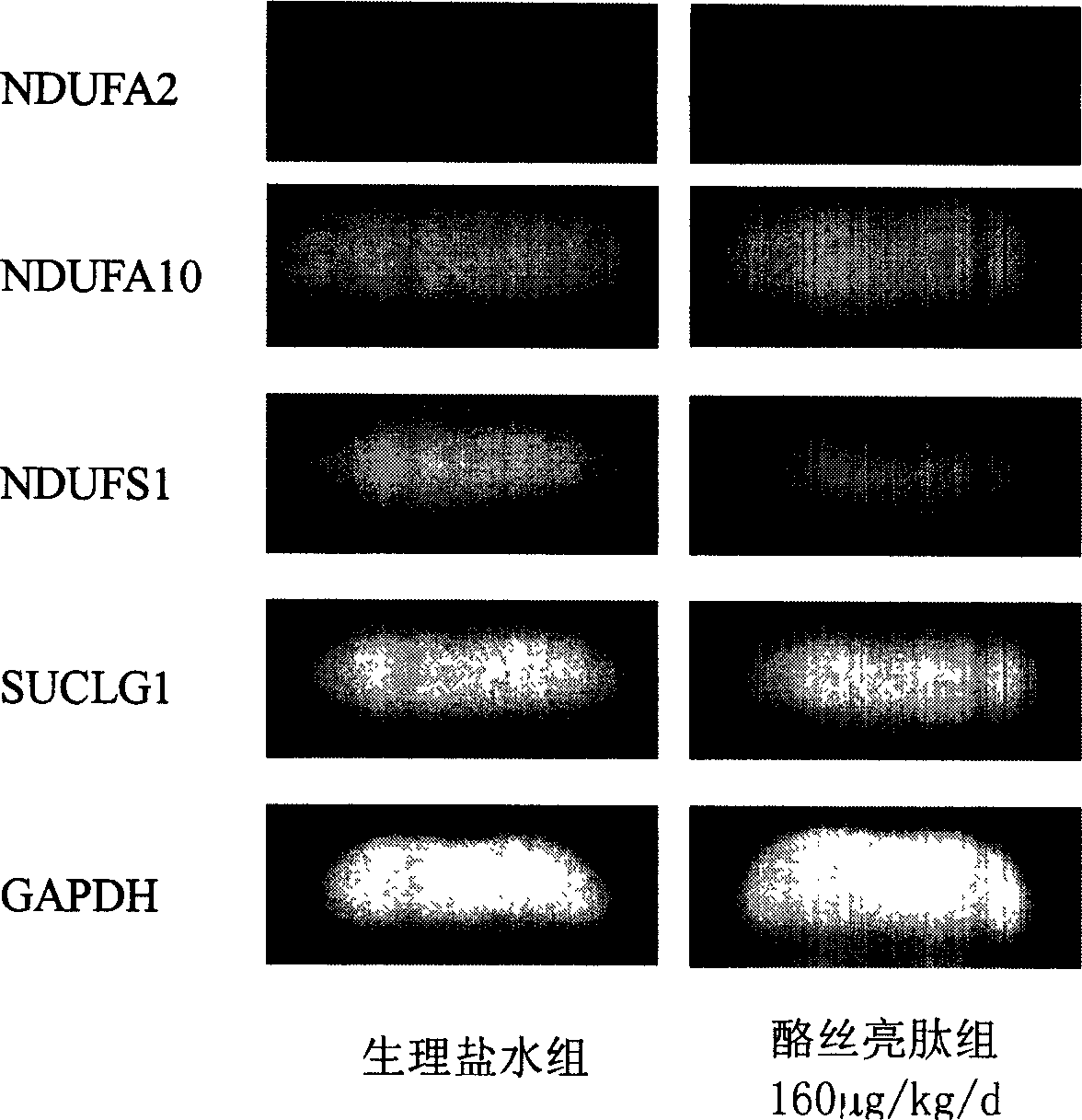 Method for detecting anti-liver cancer efficacy of tyroserleutide, kit and gene chip used thereby