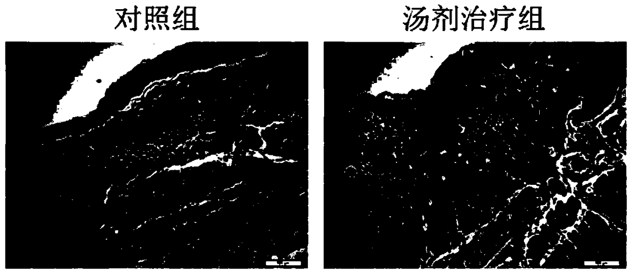 A compound traditional Chinese medicine composition for treating ulcerative colitis and its preparation method and preparation