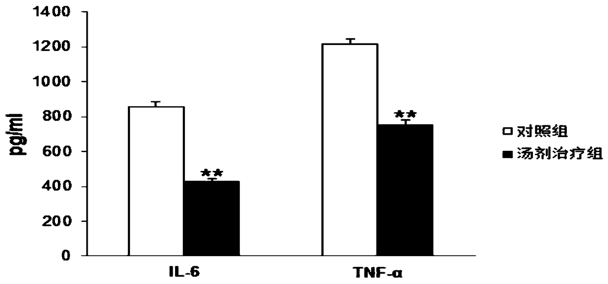 A compound traditional Chinese medicine composition for treating ulcerative colitis and its preparation method and preparation