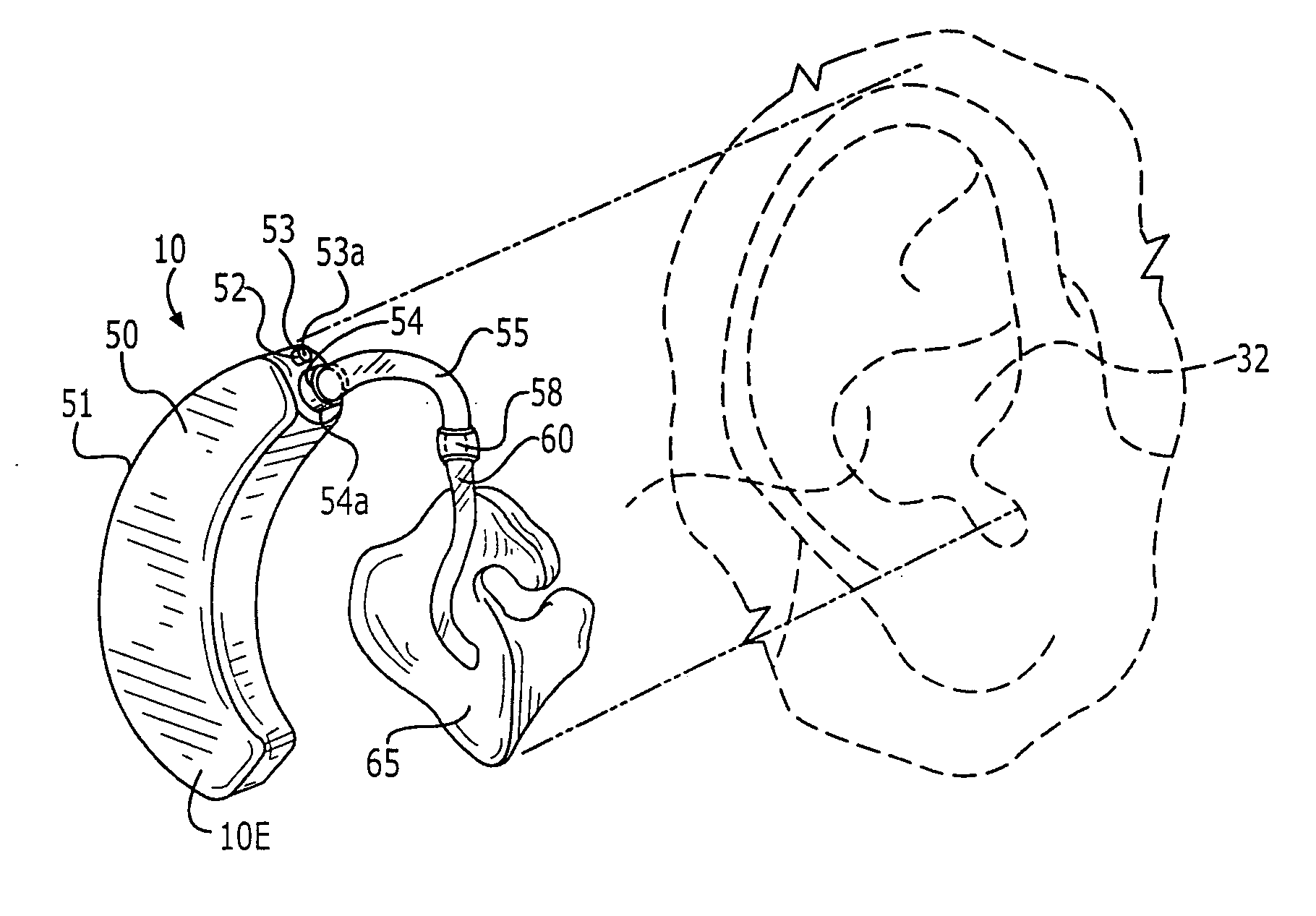 Adaptation resistant anti-stuttering devices and related methods